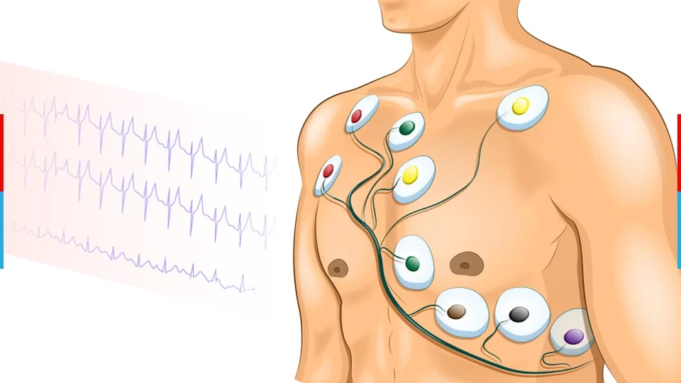 Best ECG Test Lab